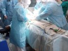Хирурги отделения портальной гипертензии выполнили сложнейшую операцию на печени пациенту с диагнозом - гепатоцеллюлярная карцинома печени 3 а стадия с применением методики двухэтапной резекции печени.