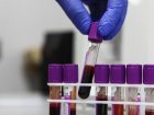 В ФМБА рассказали о росте числа доноров костного мозга благодаря регистру.