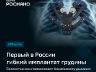 Новые возможности медицины: Ученые из Группы «РОСНАНО» создали первый в России гибкий имплантат грудины
